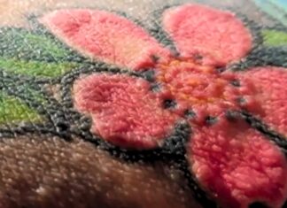 Сильна алергічна реакція на червоне чорнило для татуювань призводить до років поганого здоров’я