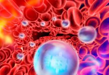 Нанотерапія демонструє багатообіцяючі результати щодо зменшення болю та смертності від раку кісток