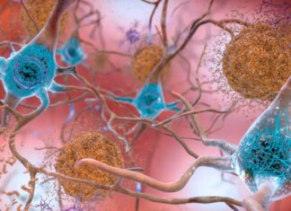 Стійкість до хвороби Альцгеймера: чому деякі мозки протистоять занепаду, незважаючи на пошкодження