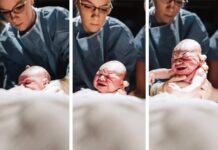 Il collo di bottiglia evolutivo: perché il parto rimane difficile e cosa significa per il futuro