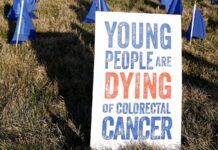 El misterio sin resolver del aumento de las tasas de cáncer en adultos jóvenes